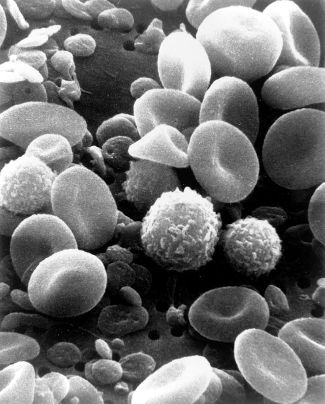 A scanning electron microscope image of normal circulating human blood. One can see red blood cells, several knobby white blood cells including lymphocytes, a monocyte, a neutrophil, and many small disc-shaped platelets.
