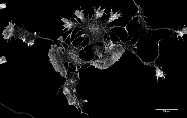 Actin filaments in a mouse Cortical Neuron in culture
