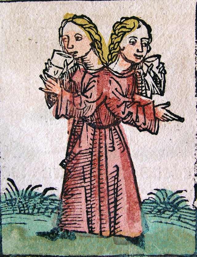 Conjoined twin sisters from Nuremberg Chronicle (1493)