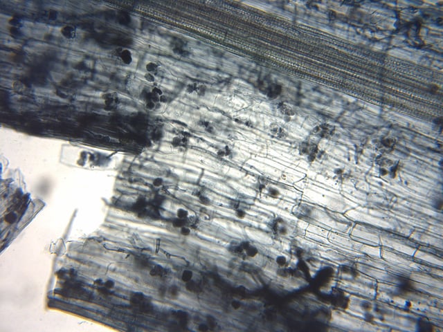 Arbuscular mycorrhiza seen under microscope. Flax root cortical cells containing paired arbuscules.