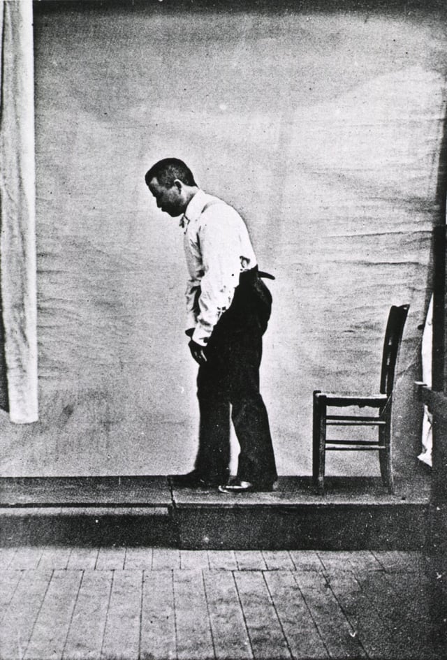 A man with Parkinson's disease displaying a flexed walking posture pictured in 1892