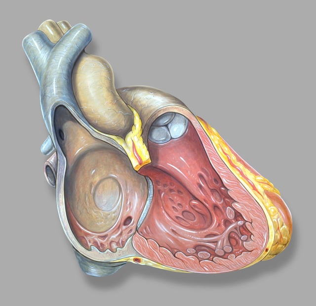 Right heart anatomy