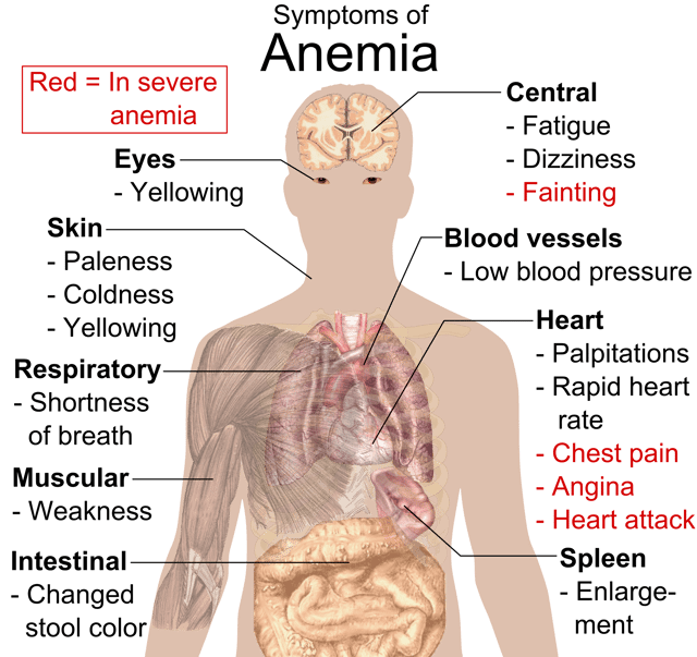 Main symptoms that may appear in anemia