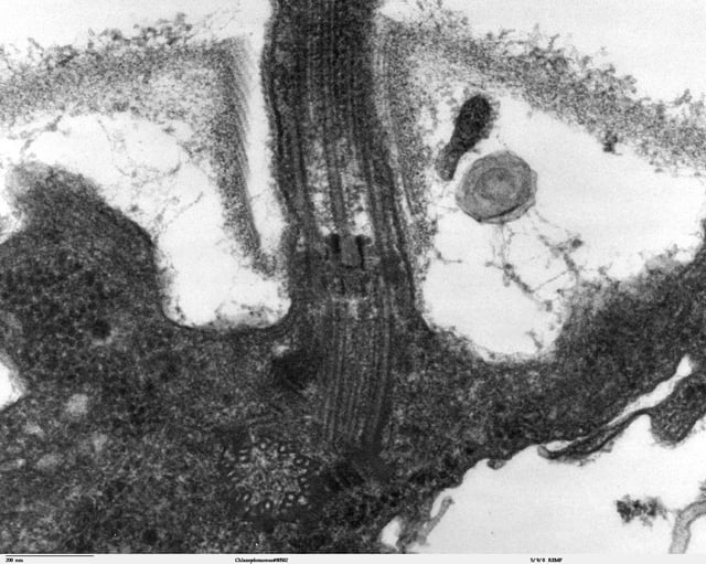 Longitudinal section through the flagellum of Chlamydomonas reinhardtii