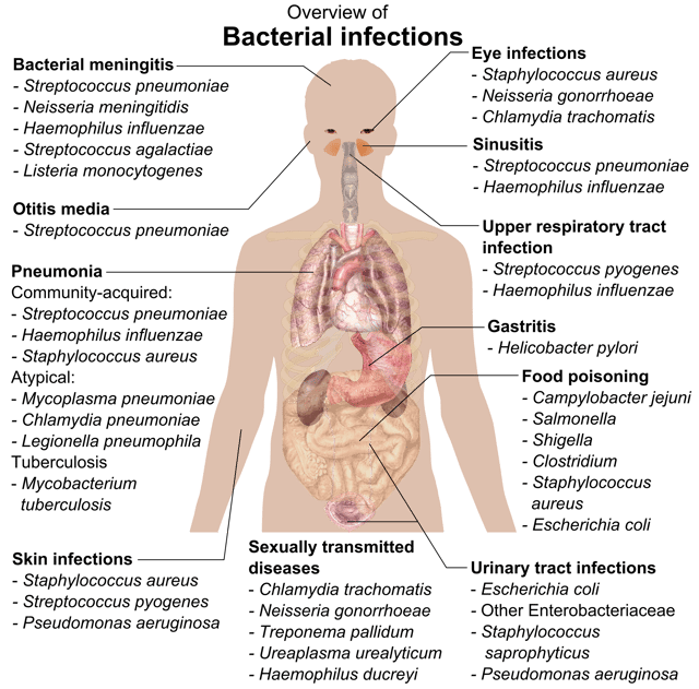 Overview of bacterial infections and main species involved.