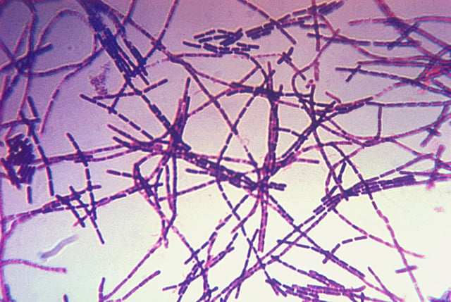 Photomicrograph of a Gram stain of the bacterium Bacillus anthracis, the cause of the anthrax disease