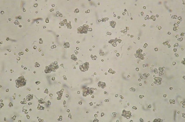 Rice starch seen on light microscope. Characteristic for the rice starch is that starch granules have an angular outline and some of them are attached to each other and form larger granules