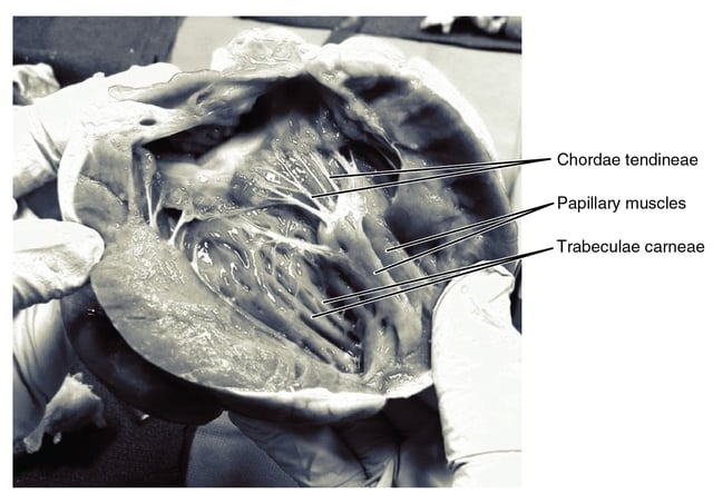 Frontal section showing papillary muscles attached to the tricuspid valve on the right and to the mitral valve on the left via chordae tendineae.