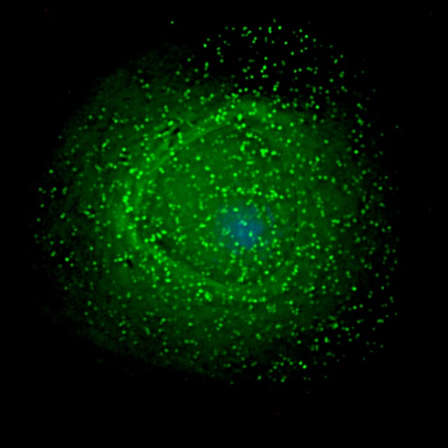 HIV assembling on the surface of an infected macrophage. The HIV virions have been marked with a green fluorescent tag and then viewed under a fluorescent microscope.