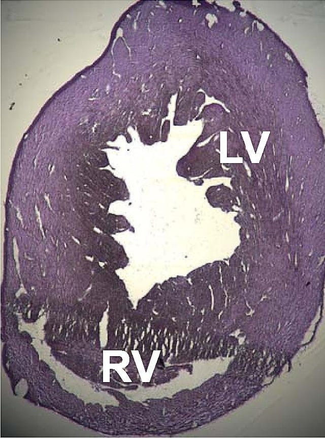 Cross section of a rat heart that is showing signs of dilated cardiomyopathy