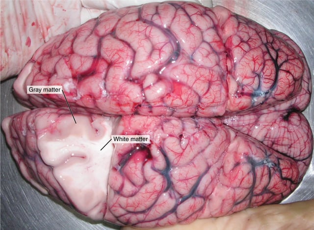 Dissection of a brain with labels showing the clear division between white and gray matter.