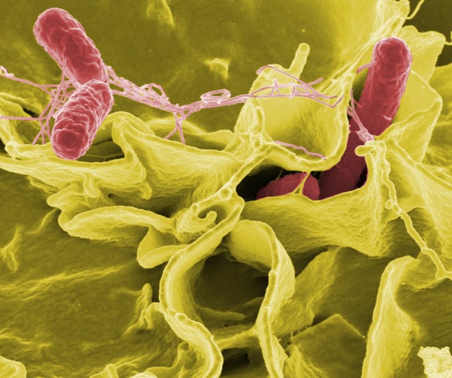 Colour-enhanced scanning electron micrograph showing Salmonella typhimurium