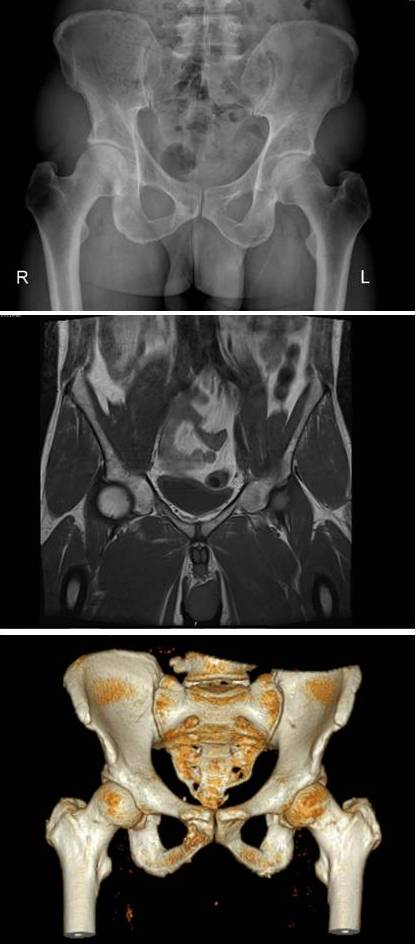 The same human pelvis, front imaged by x-ray (top), magnetic resonance imaging (middle), and 3-dimensional computed tomography (bottom).