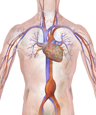 Illustration depicting location of abdominal aneurysm