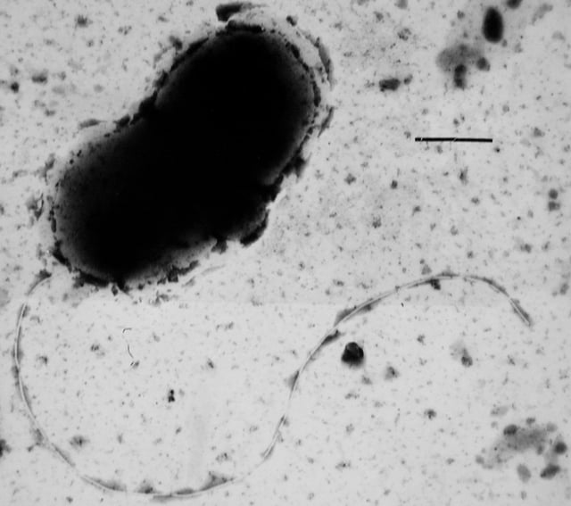 Transmission electron micrograph of Desulfovibrio vulgaris