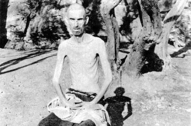 Emaciated male inmate at the Italian Rab concentration camp