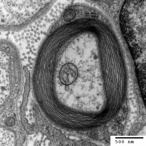 Transmission electron micrograph of a myelinated axon in cross-section. Generated by the electron microscopy unit at Trinity College, Hartford CT
