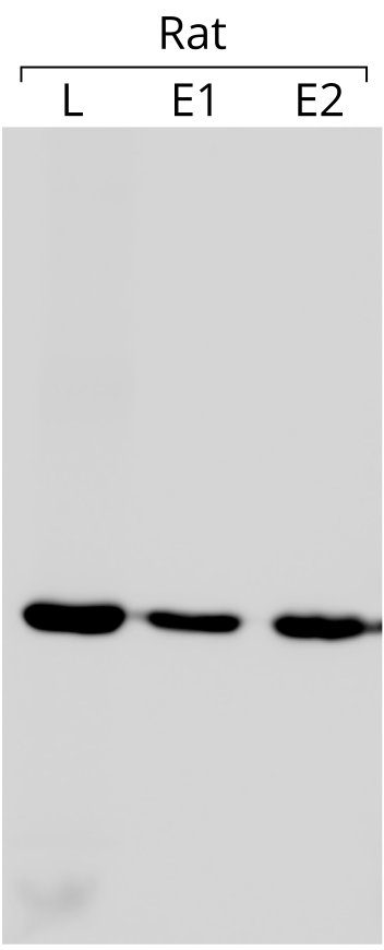 Western blot for cytoplasmic actin from rat lung and epididymis