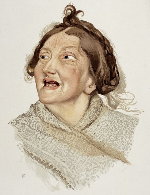 An 1892 color lithograph depicting a woman diagnosed with "Hilarious Mania"