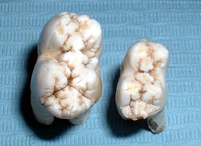 Pig tooth