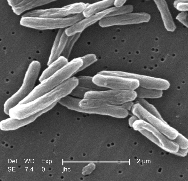 Scanning electron micrograph of M. tuberculosis