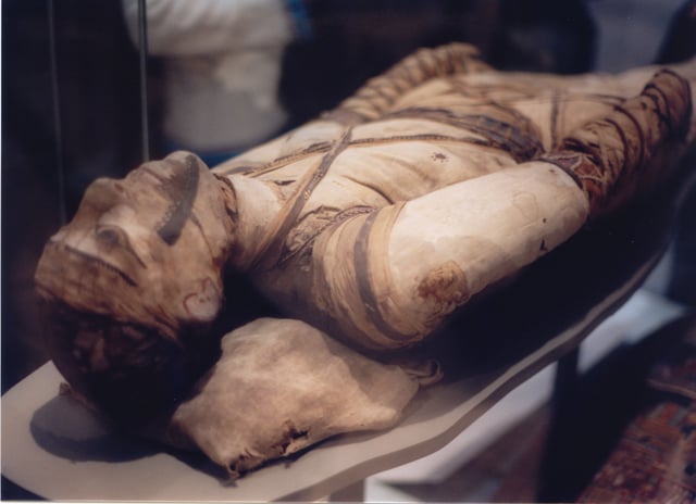 Egyptian mummy in the British Museum – tubercular decay has been found in the spine.
