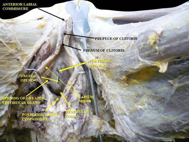 Clitoris; deep dissection