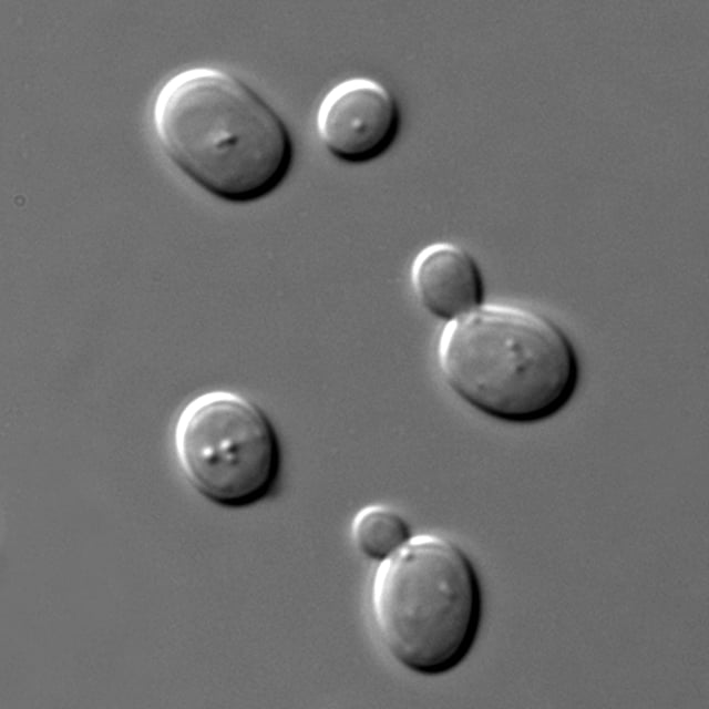 Saccharomyces cerevisiae cells shown with DIC microscopy