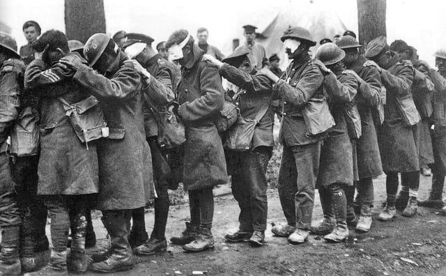 British 55th Division soldiers blinded by tear gas during the Battle of Estaires, 10 April 1918