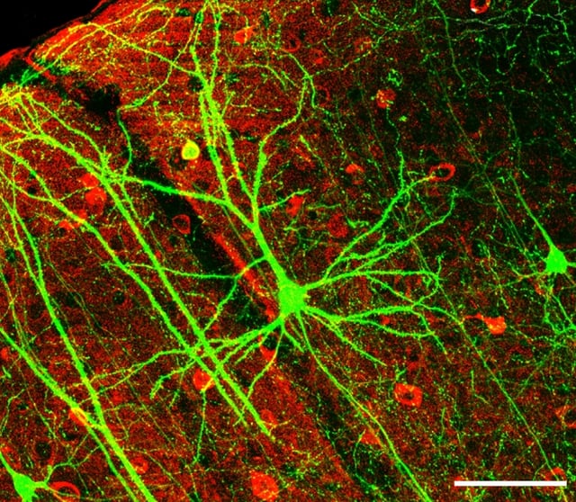 Neurons often have extensive networks of dendrites, which receive synaptic connections. Shown is a pyramidal neuron from the hippocampus, stained for green fluorescent protein.