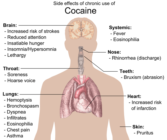 Side effects of chronic cocaine use