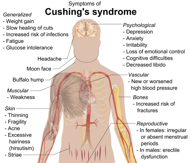 Symptoms of Cushing's syndrome