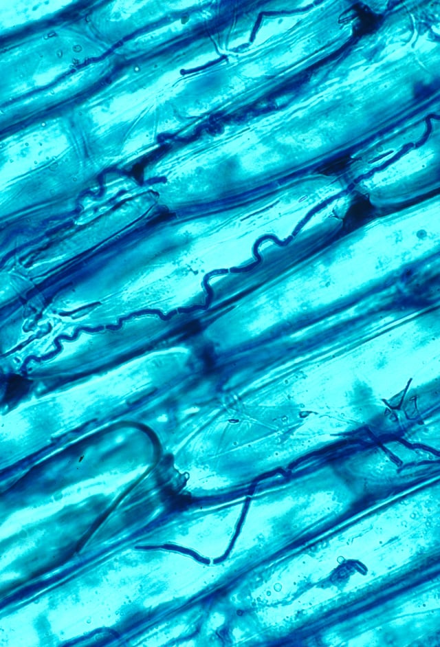 The dark filaments are hyphae of the endophytic fungus Neotyphodium coenophialum in the intercellular spaces of tall fescue leaf sheath tissue