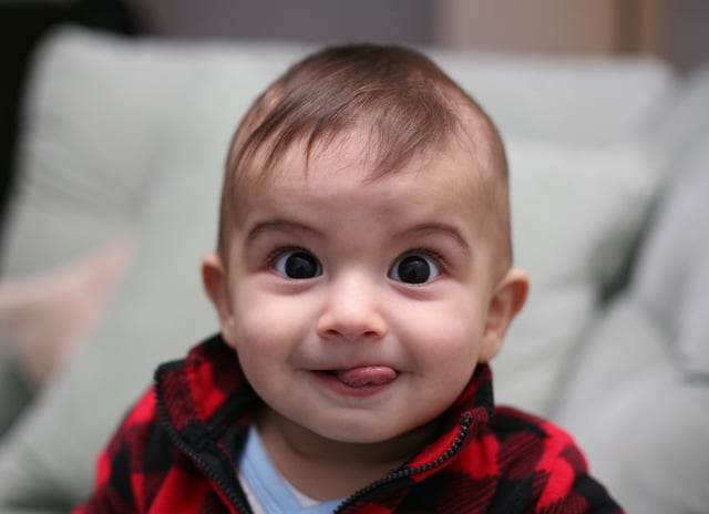 Eight month-old infant; as a common feature eyes are usually large in relation to the face.