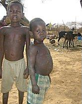 Malnourished children in Niger, during the 2005 famine.