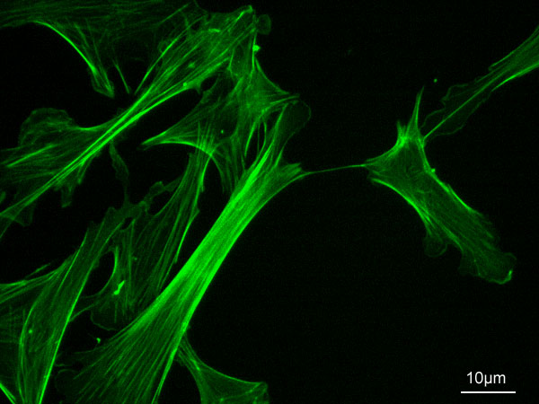Fluorescence micrograph showing F-actin (in green) in rat fibroblasts