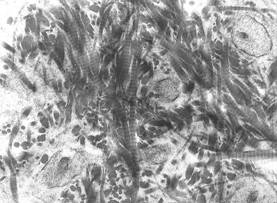 Transmission electron micrograph of decalcified woven bone matrix displaying characteristic irregular orientation of collagen fibers.