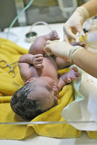 A newborn baby in Indonesia, with umbilical cord ready to be clamped