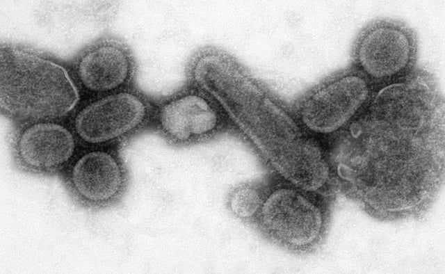 An electron micrograph showing recreated 1918 influenza virions