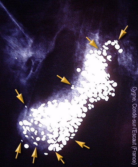 Radiography of a swan found dead in Condé-sur-l'Escaut (northern France), highlighting lead shot. There are hundreds of lead pellets; a dozen is enough to kill an adult swan within a few days. Such bodies are sources of environmental contamination by lead.