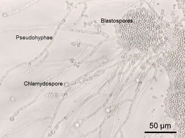 A photomicrograph of Candida albicans showing hyphal outgrowth and other morphological characteristics