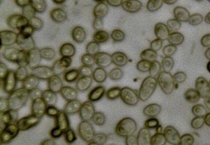 Yeast and bacteria in kombucha at 400×
