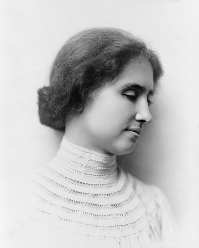 Helen Keller portrait, 1904. Due to a protruding left eye, Keller was usually photographed in profile. Both her eyes were replaced in adulthood with glass replicas for "medical and cosmetic reasons".