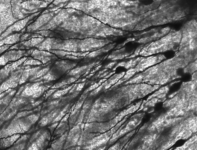 Golgi-stained neurons in human hippocampal tissue