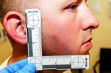 Bruising on Wilson's face after the shooting