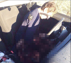 Photo taken of Alexander 'Sasha' Chechik after accidentally blowing himself up with a grenade.
