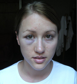 Photo of Colbie Paulson that was taken by Rob Porter after he punched her.