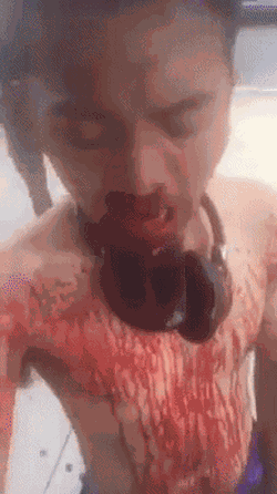 His injuries