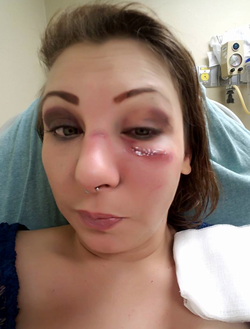Selfie Kristen Leigh McDowell shared while in the hospital getting treatment for her injuries after being assaulted by six men.