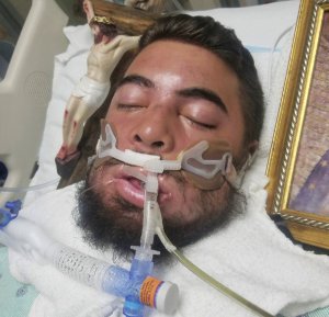 John Hernandez before his death at a Texas hospital after being choked by Terry Thompson